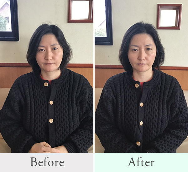 40代 女性ビフォーアフター1