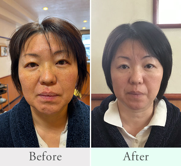 50代 女性ビフォーアフター