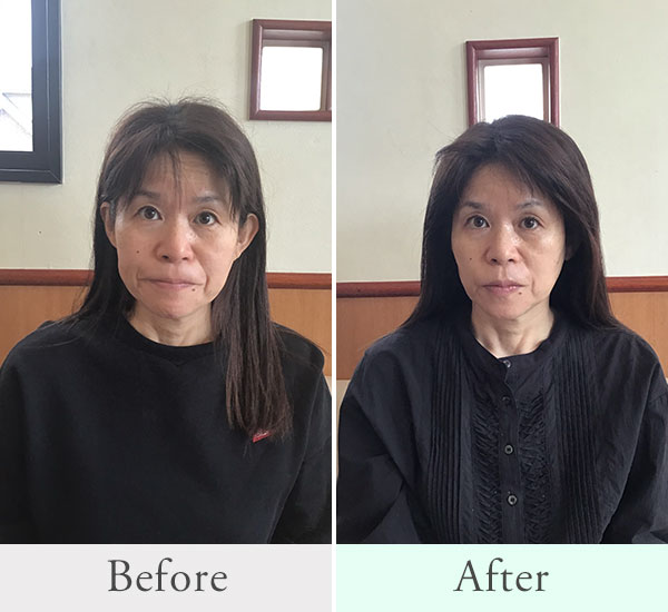 50代 女性ビフォーアフター2