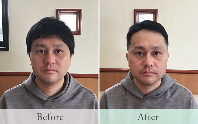 30代 看護師のビフォーアフター